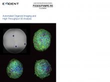 Automated Organoid Imaging and High-Throughput 3D Analysis