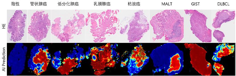 図1.AI病理診断支援ソフトウェアの推論結果イメージ