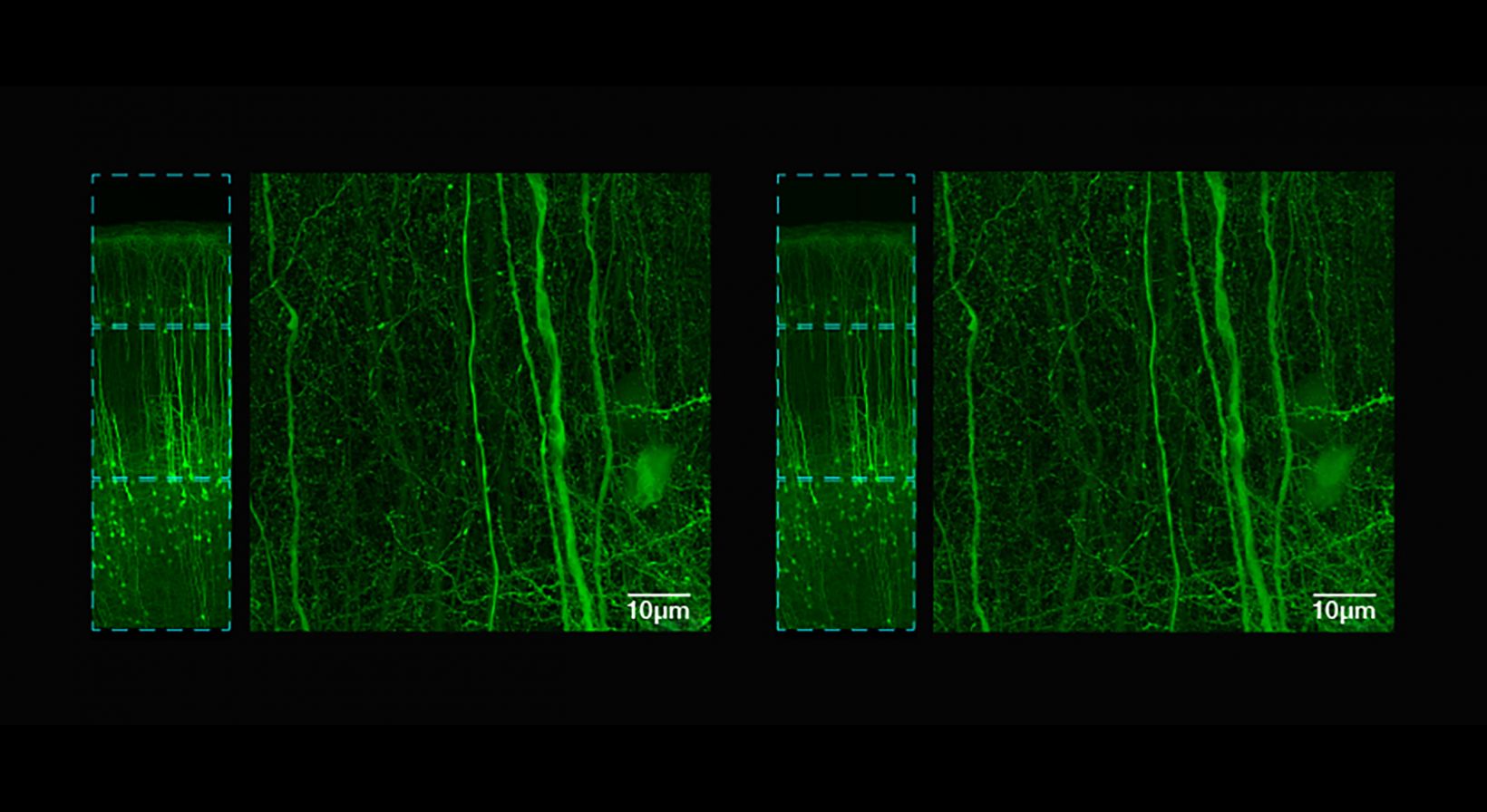 Comparison images showing images captured with the FV5000’s galvo (left) and resonant (right) scanners, highlighting that you can acquire up to nine times faster than galvo with the same stunning clarity. 