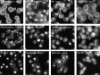 Yeast Protein Localization Classified Using TruAI™ Deep-Learning Technology