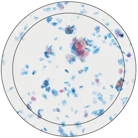 Thin layer of cells. Field of view at 20X magnification for FN22 (inner circle) and FN26.5 (outer circle)