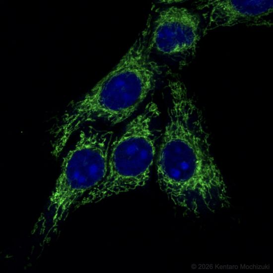 Fluorescent immunostaining image of HeLa* cells captured using an Evident FV1000 confocal microscope.