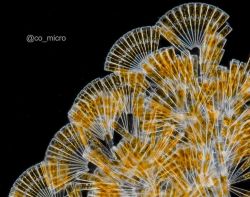 显微镜下的楔形藻属硅藻排列