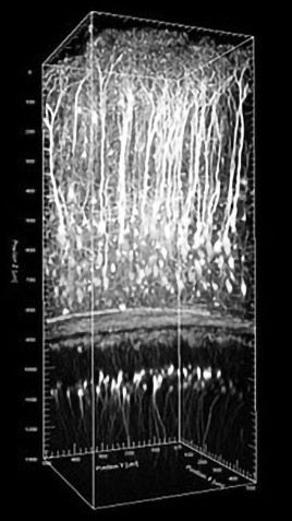 Neuroscience and Multiphoton Imaging