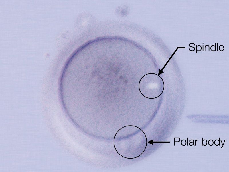 Spindle / Polar body