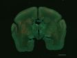 使用FLUOVIEW FV3000对狨猴大脑皮层和丘脑之间神经结构进行的观察