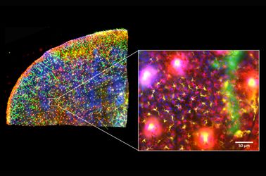 The Use of Multiplexing in Microscopy for Better Understanding the Skin Immune System in the Context of the Tissue