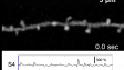 Visualization of glutamatergic synaptic inputs in vivo mouse FrA cortex using iGluSnFR.