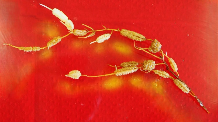 Comparative images of primary cilia in the brains of control mice and mice subjected to 21 days of stress.