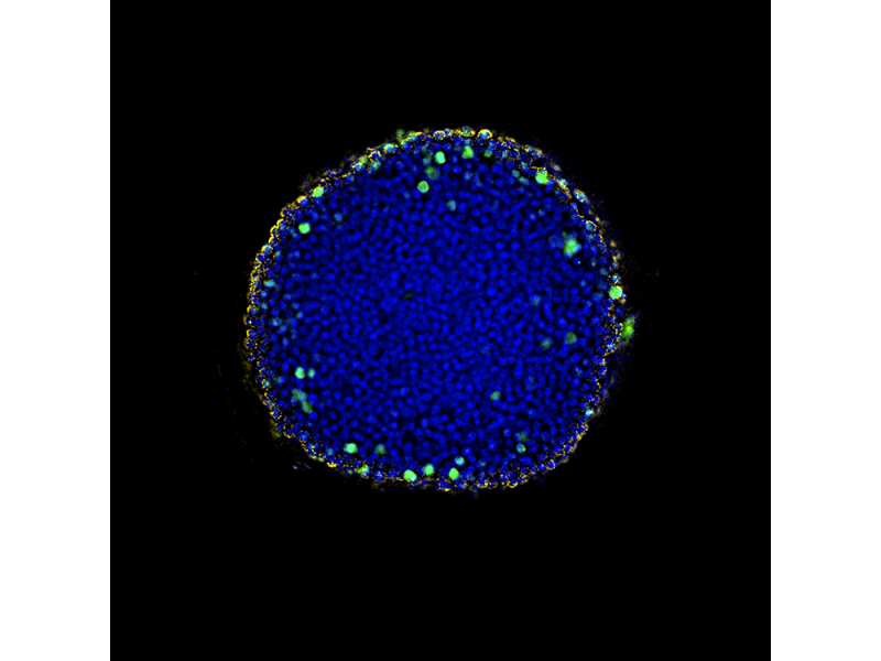 透明化HeLa细胞球体的应用图像