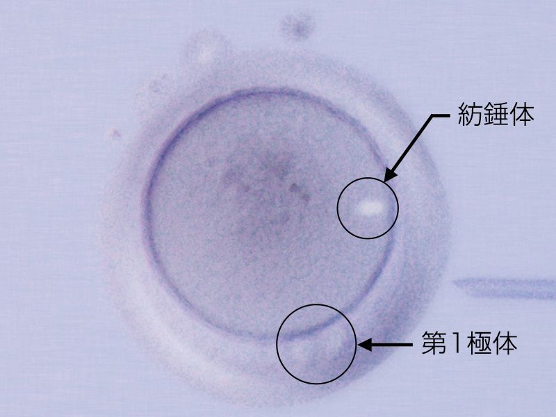 紡錘体/第1極体