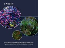 推进您的神经科学研究: 使用共焦和多光子显微术的应用示例