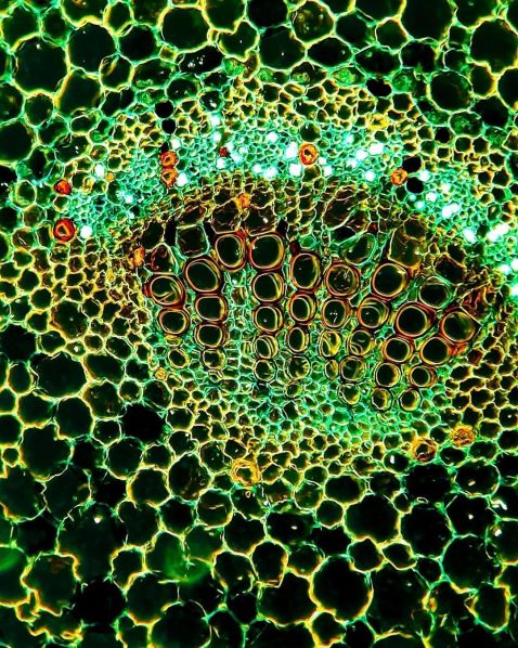 显微镜下的双子叶植物茎部