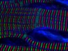 Microscopic Art from the Heart—6th Annual Image of the Year APAC Winner
