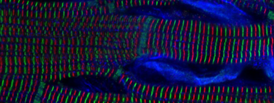 Evident Image of the Year Award 2025: APAC Winner. Sarcomere structures within cardiomyocytes in a rat heart. Captured by Kentaro Mochizuki, Japan.