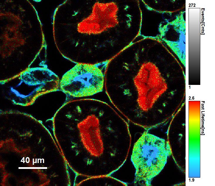 Single-molecule sensitivity in confocal microscopy