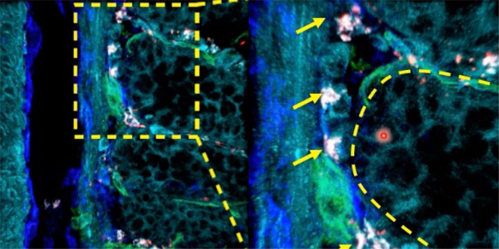 Study the Function of Stromal Cells through Intestinal Organoid Co-Culture Technology