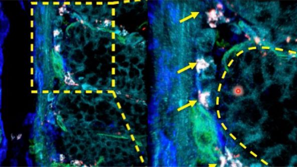 Study the Function of Stromal Cells through Intestinal Organoid Co-Culture Technology