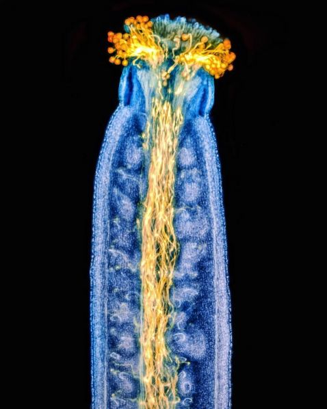 花粉管从拟南芥的雌蕊中生长而出