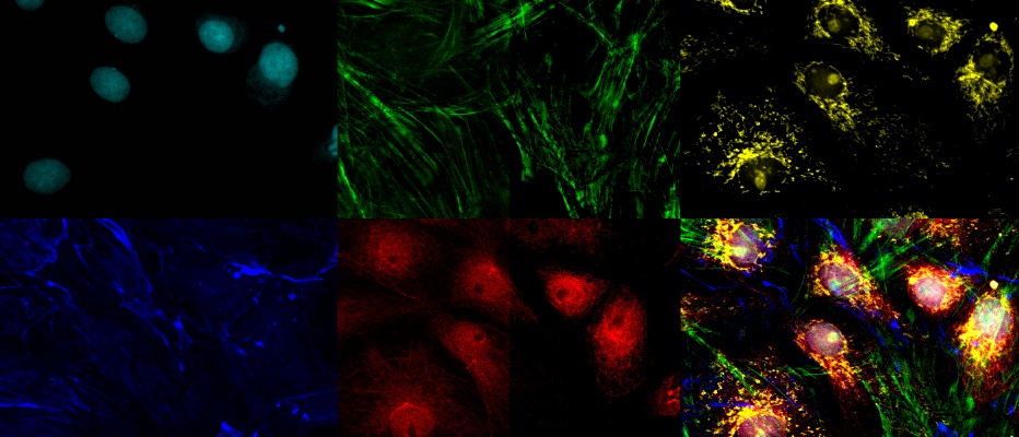 Multiplexing and Deep Tissue Imaging with Near-Infrared Confocal Laser Scanning Microscopy