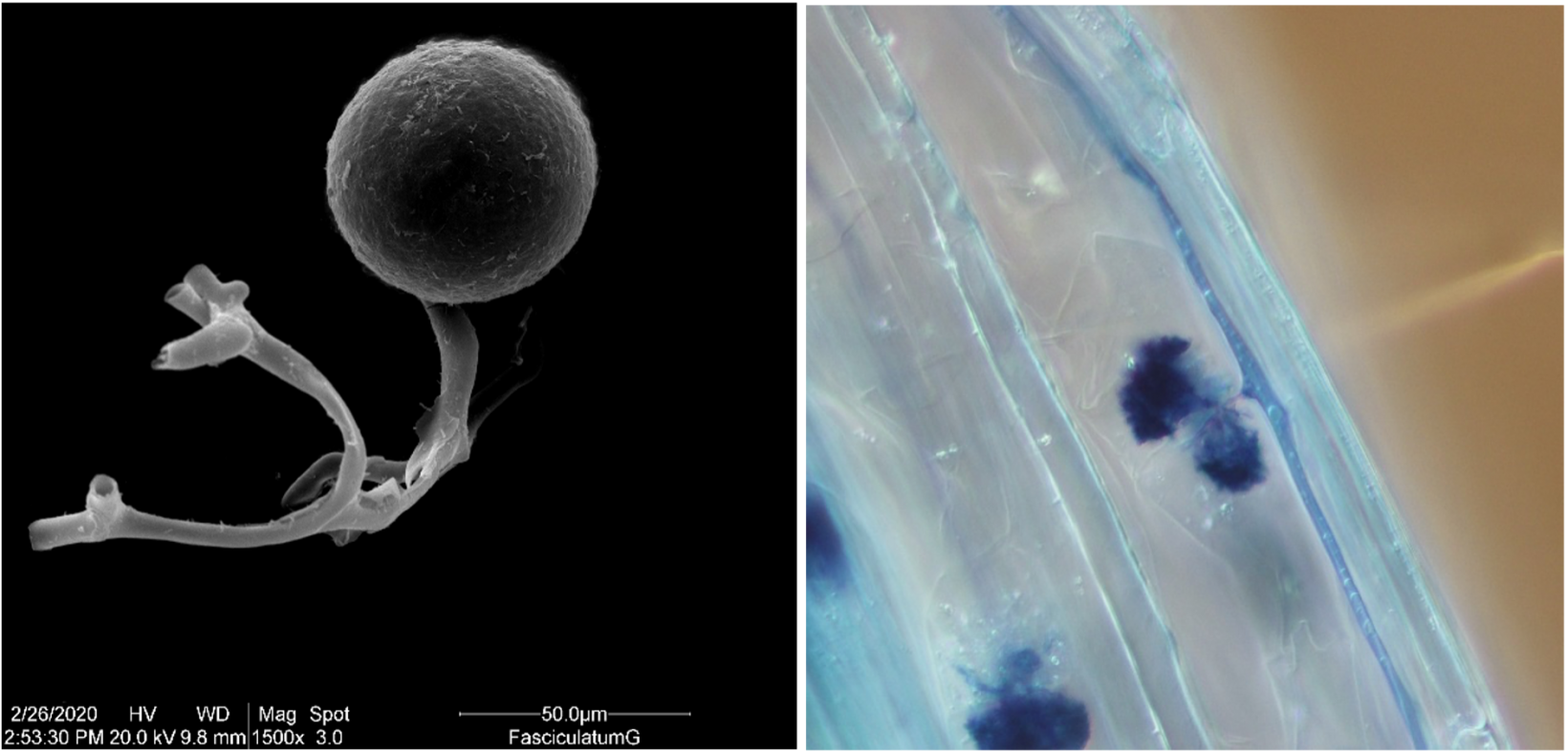 显微镜下的菌根孢子和菌根真菌结构的“丛枝”。