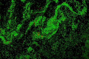 Confocal Microscopy and Its Use for a Spaceflight Experiment