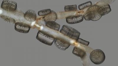 显微镜下的日本蛛网膜硅藻