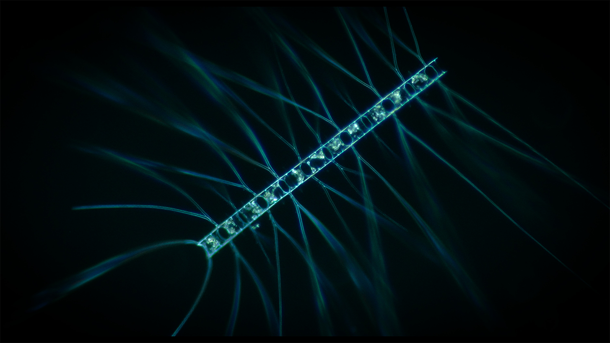 Phytoplankton samples from the High Arctic under a microscope. Image courtesy of National Geographic/Jan van IJken.