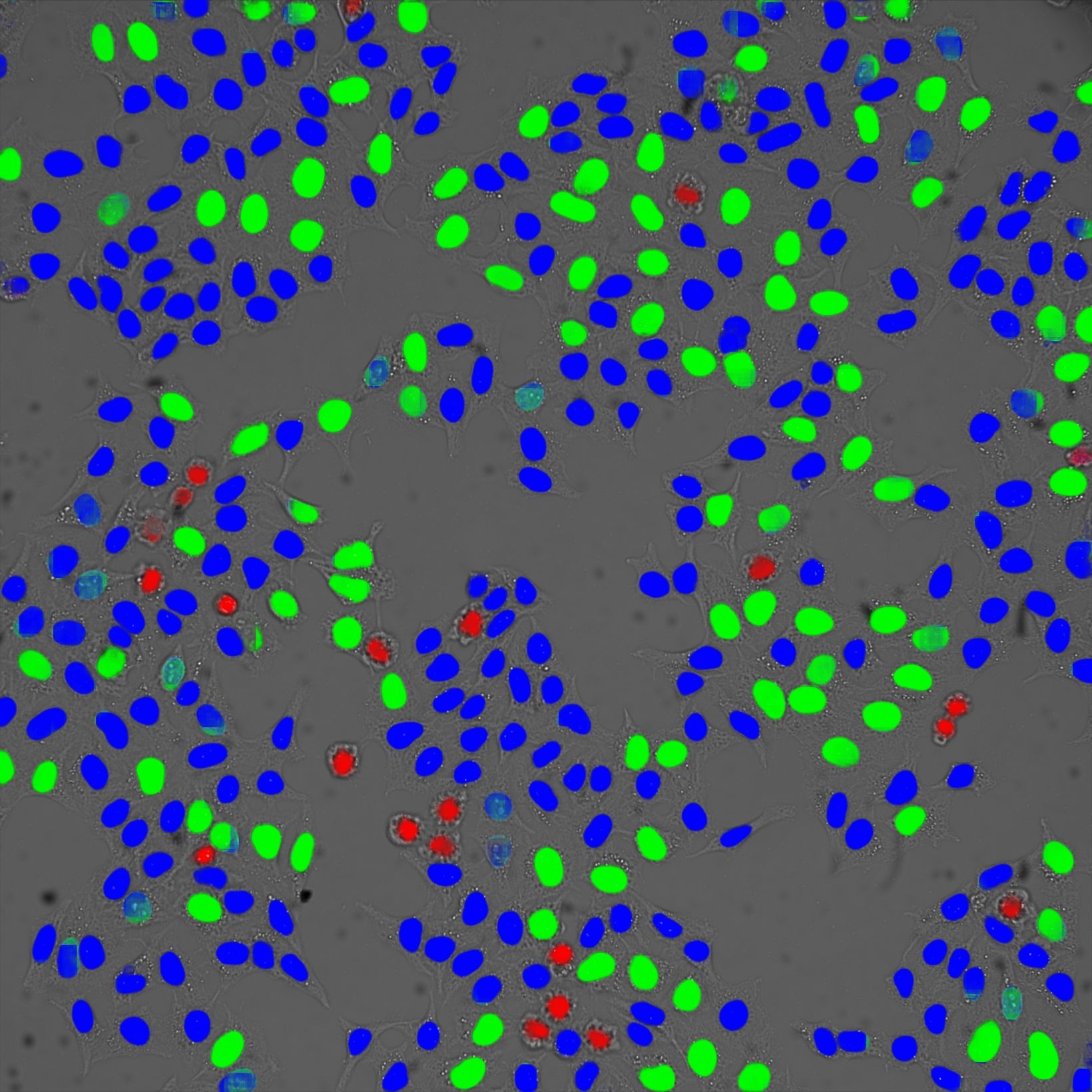 Cell cycle classification in brightfield based on deep learning