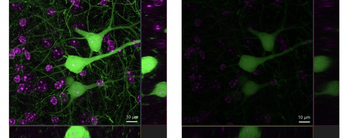 Confocal imaging of a mouse brain slice, showing that the TruResolution system enables acquisition of brighter, higher resolution images.