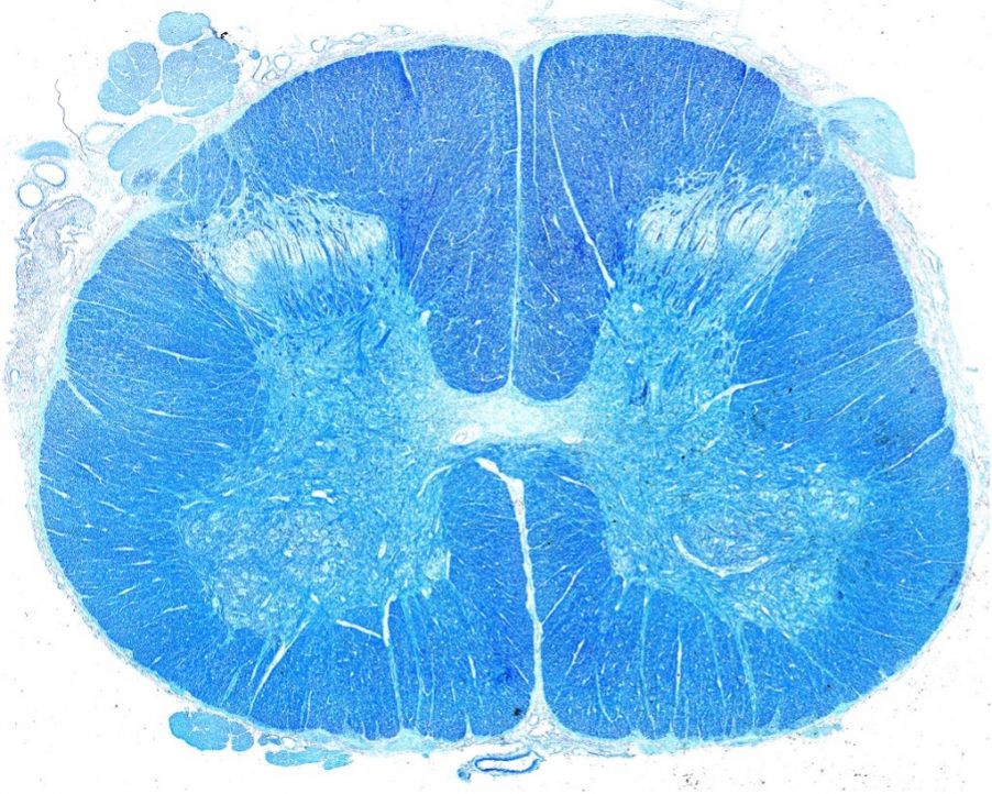 染色后的人类脊髓全玻片图像