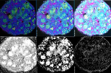 Metabolic Imaging in Langerhans Human Islets with MPE and FLIM