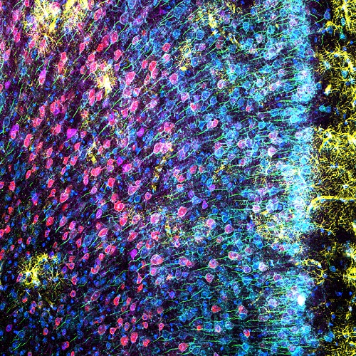 図2:Mouse mPFC labeled with glial fibrillary acidic protein (GFAP; astrocyte marker; yellow), calmodulin-dependent protein kinase II (CaMKII; pyramidal neuron marker; red), amphoterin-induced protein 1 precursor (AMIGO-1; neuronal membrane marker; cyan), parvalbumin (PV; inhibitory neuron marker; purple), ankyrin-G (AnkG; axon initial segment marker; green), and nuclear yellow (nuclei marker; blue).