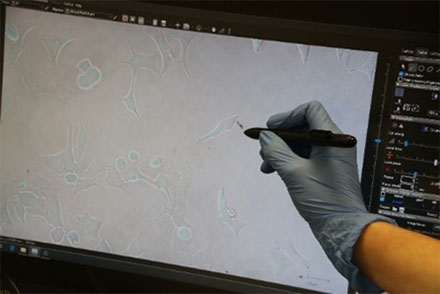 Figure 3: HeLa cell* being selected using the interactive pen screen on the MMI CellCut.