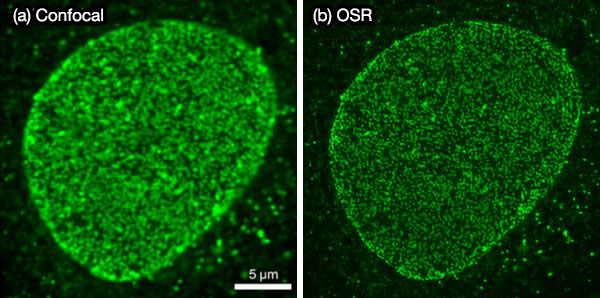 Figure 7. Fluorescence image of a stained nuclear pore in a fixed cell: (a) image by the IXplore SpinSR system with OSR and an image (b) by a confocal microscope.