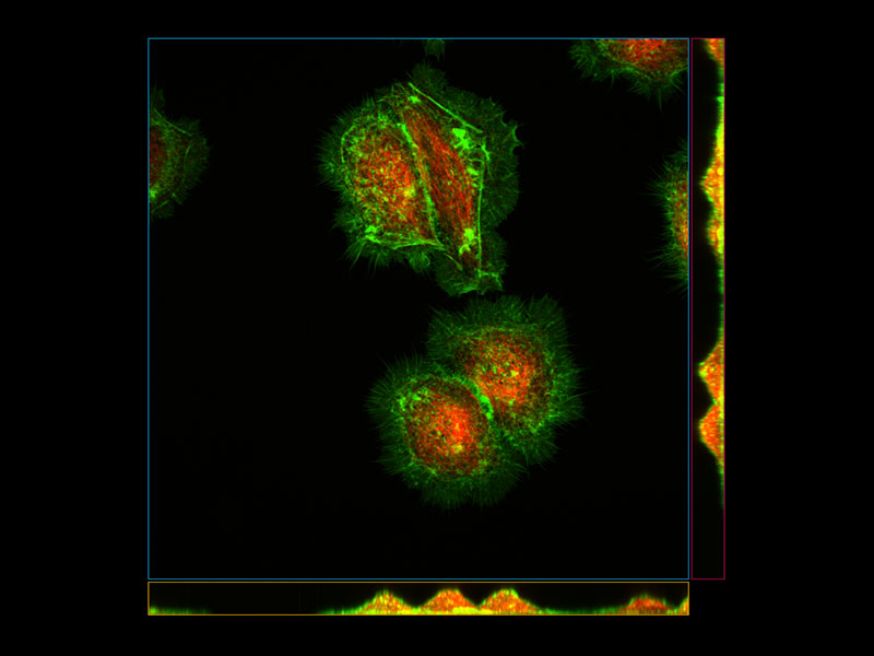 Image: HeLa cells (Green: Actin, Red: Tubulin)