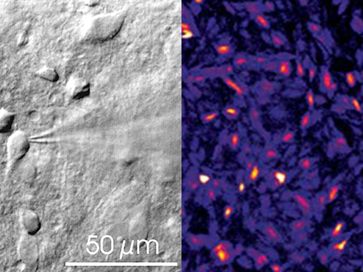 Subcellular Luminescence and Electrophysiology Systems