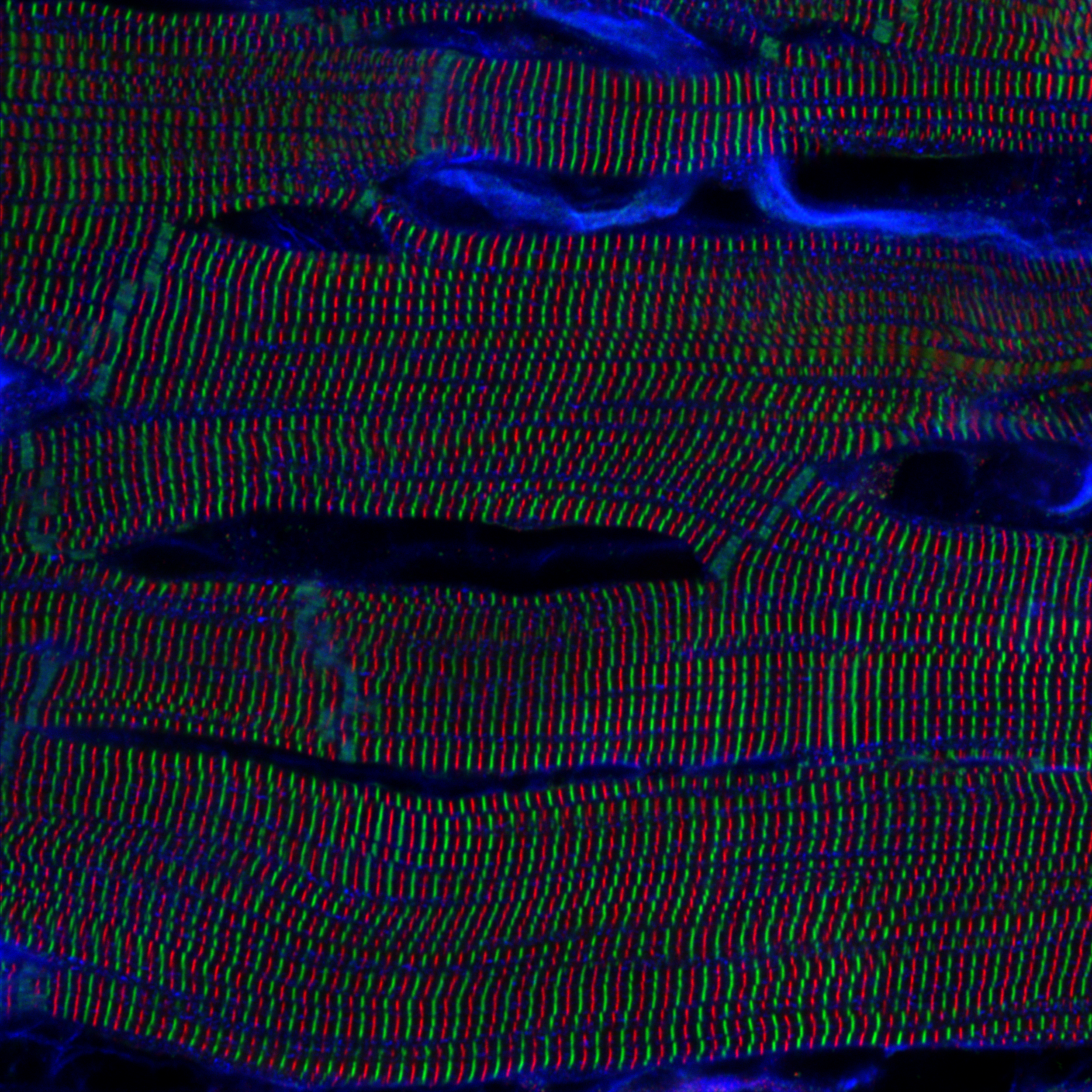 Sarcomere structures within cardiomyocytes in a rat heart. Captured by Kentaro Mochizuki (Japan).