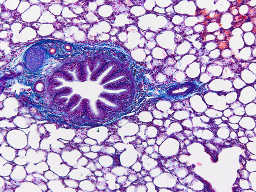 Bright field image of a lung section captured in color mode.