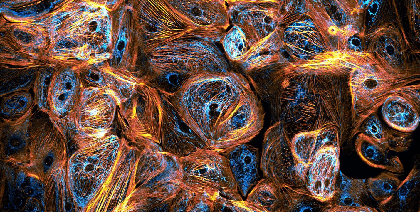 Evident Image of the Year EMEA winner: Heart cells derived from induced pluripotent stem cells. Captured by Till Stephan (Germany).