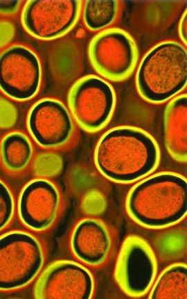 Human Roundworm
