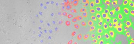 scanR AI Analysis of brightfield images
