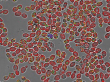 Illuminating the Unseen: The Power of scanR in Making the Invisible Visible