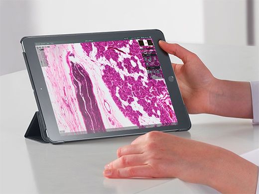 携帯Ocusスライドスキャナーで生成したデジタルスライドを用いて、携帯機器で行ったデジタル病理診断評価