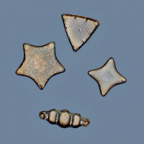 Diatom arrangement under the microscope