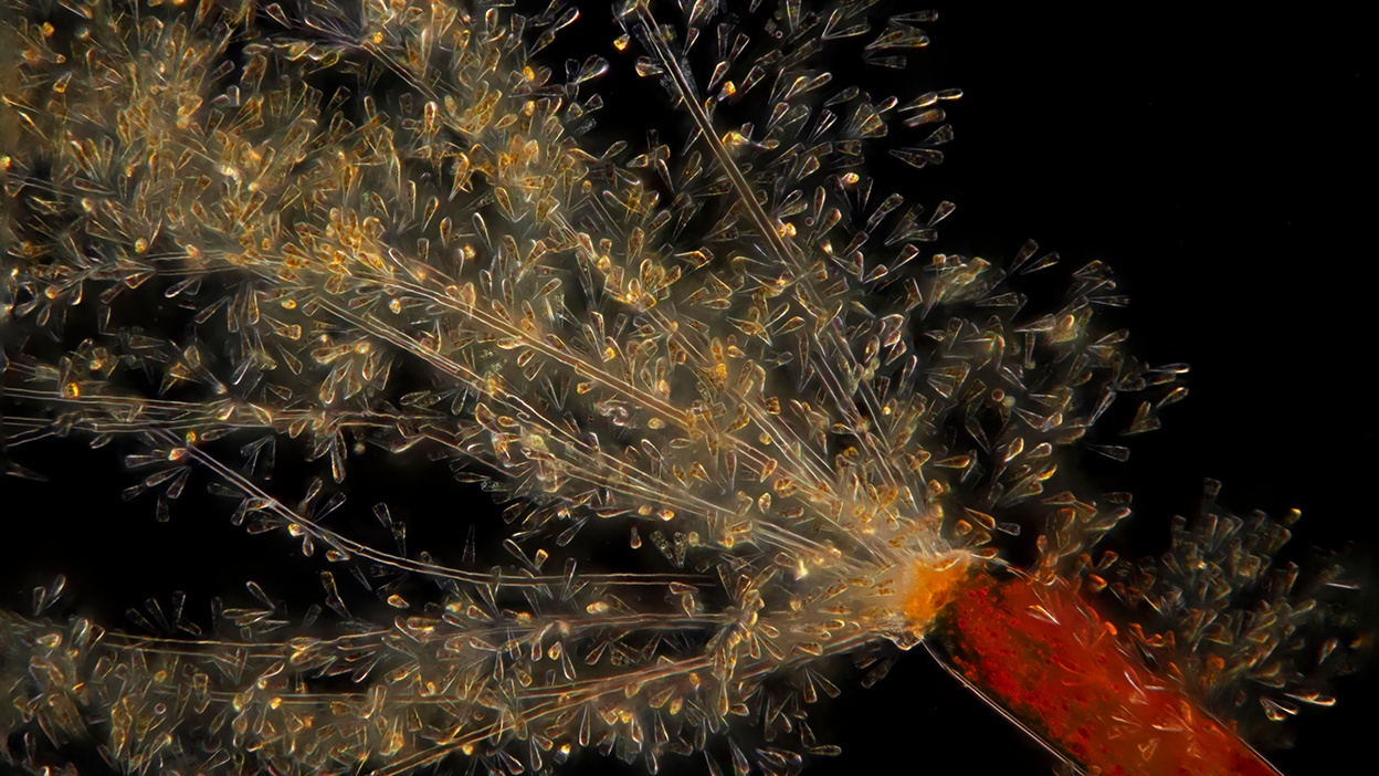 Phytoplankton samples from the High Arctic under a microscope. Image courtesy of National Geographic/Jan van IJken.