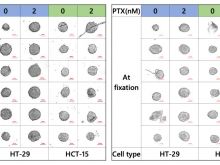 Automating the Drug Screening Process—from Cancer Spheroid Preparation to 3D Imaging Analysis