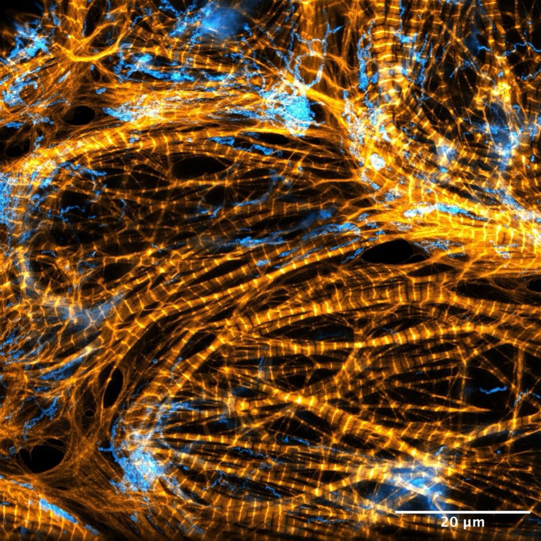 A more detailed view of actin cytoskeleton structures. Captured by Till Stephan.